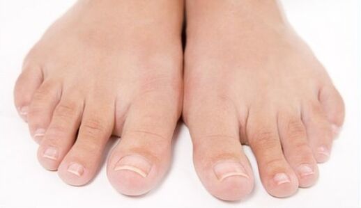 healthy feet after treatment of fungi