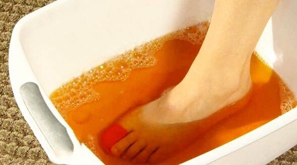 Iodine baths against foot fungus