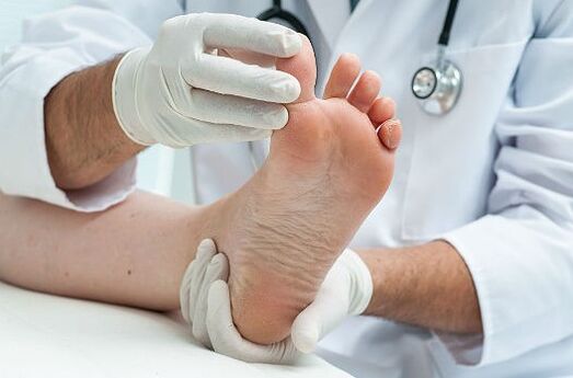 Treatment of fungi