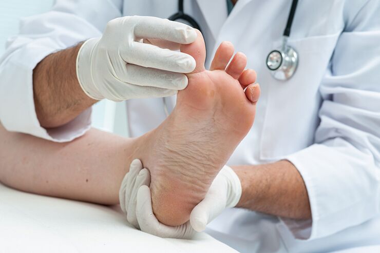 Dermatologist examines the patient's feet