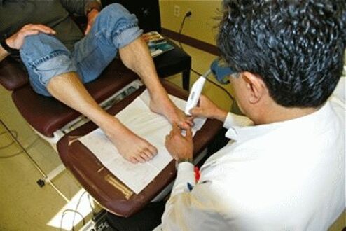 Removing the laser nail fungus
