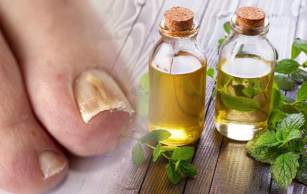 vinegar for nail fungi